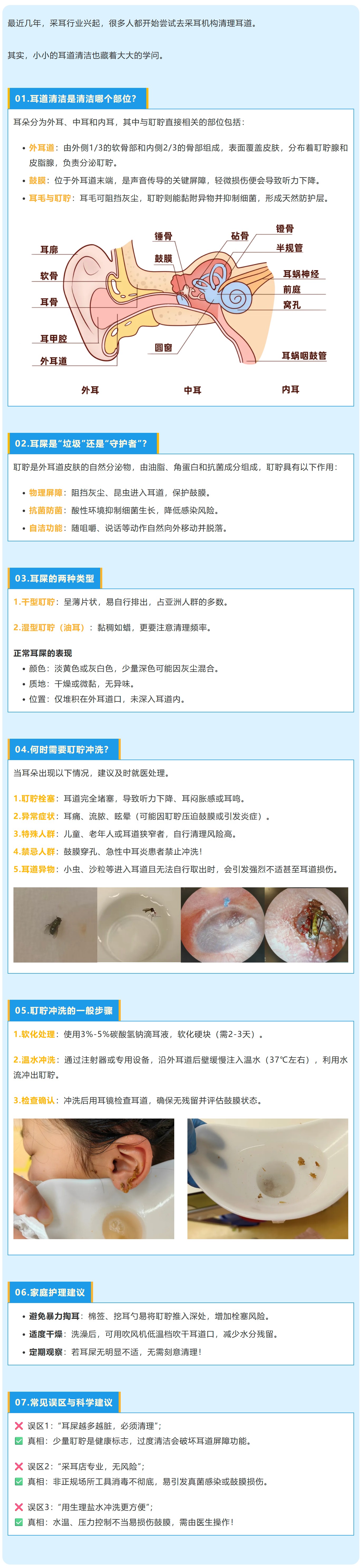 服4 想给耳朵来一场“大扫除”？耳道清洁多留意这些.jpg