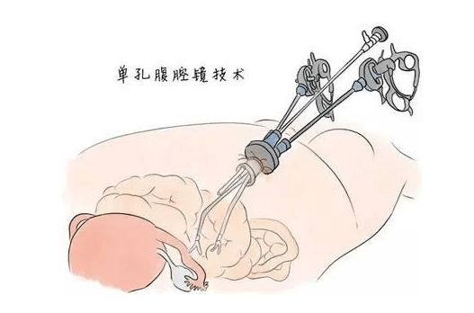 17758138996863637232.png 图片4.png